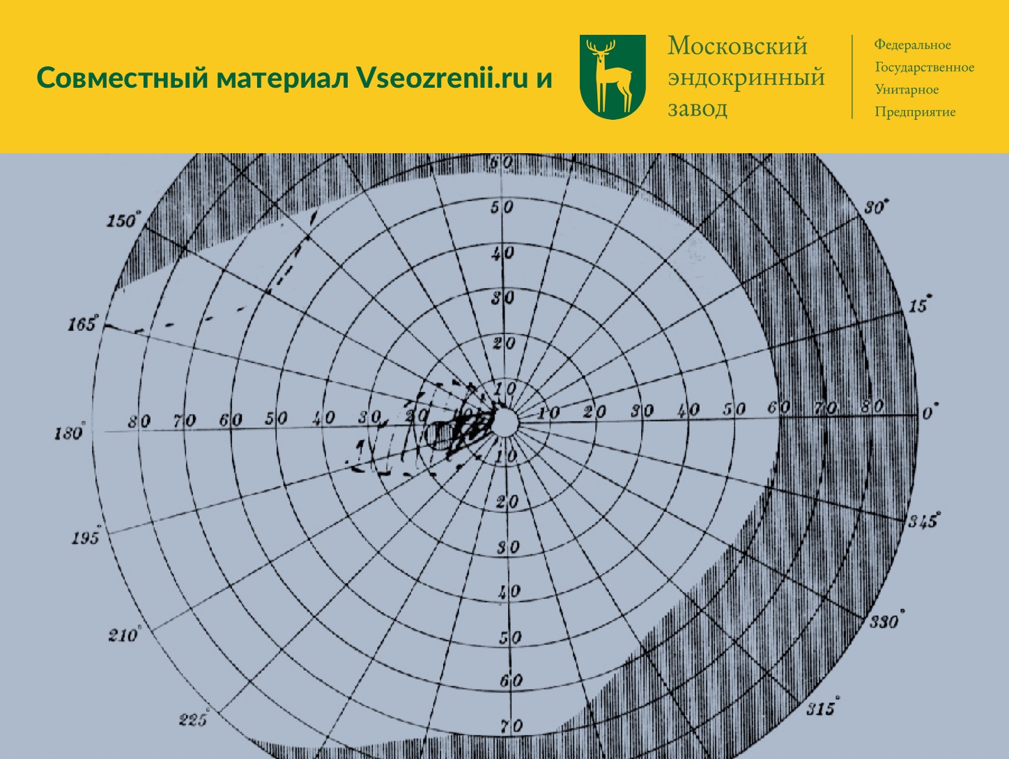 Динамическая периметрия