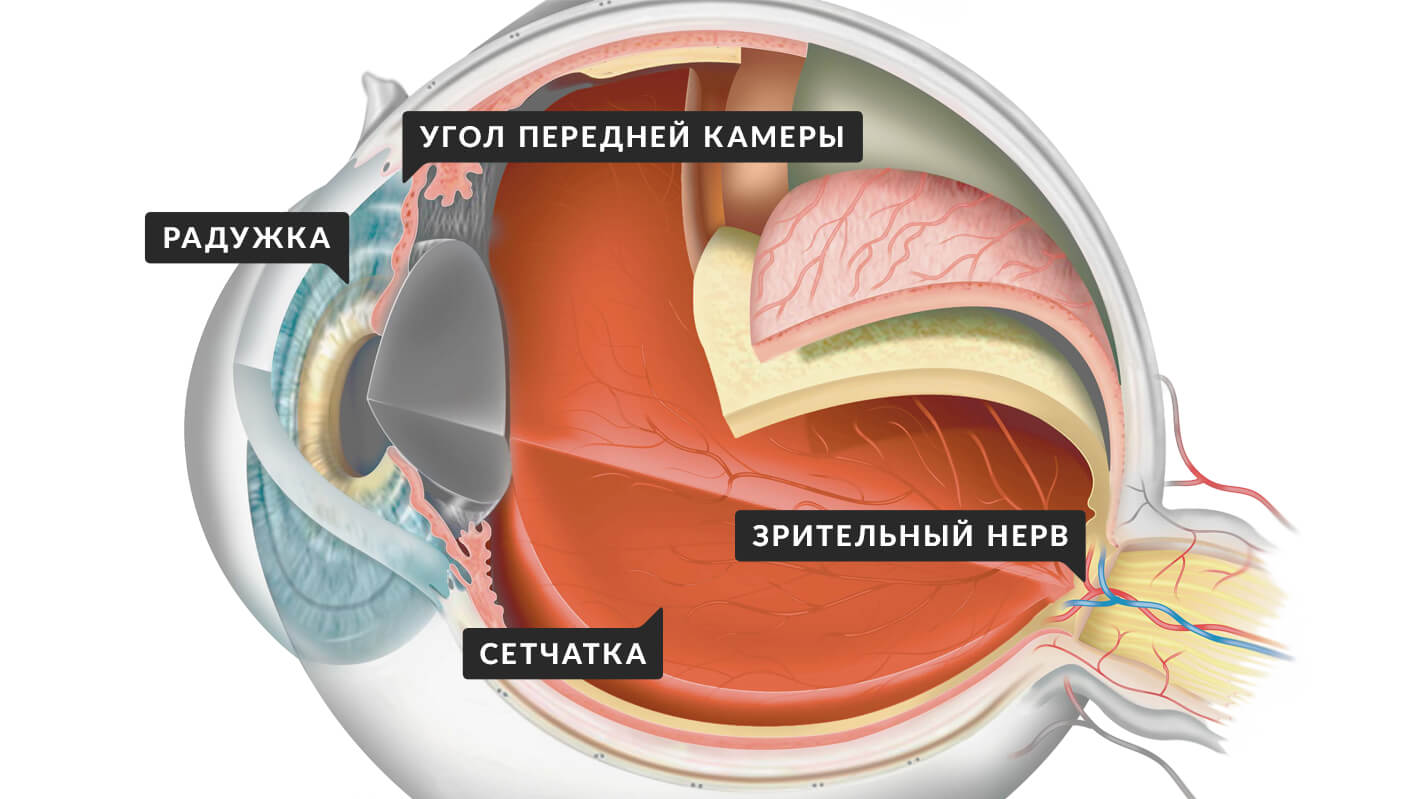novoobrazovannye-sosudy-neovaskulyarizaciya-pri-diabeticheskoj-retinopatii-6.jpg