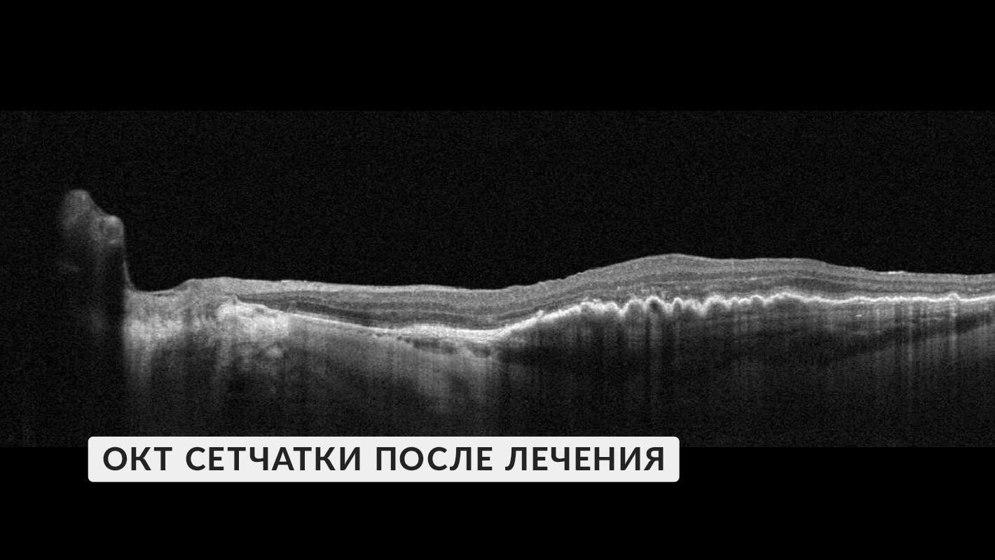 okt-posle-lecheniya-ivv-5.jpg