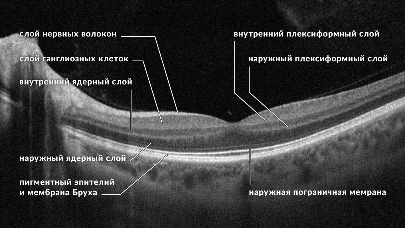 okt-setchatka-v-norme-3.jpg