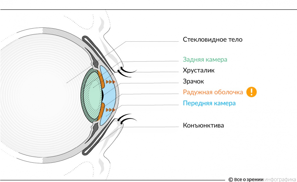 инфографика радужка