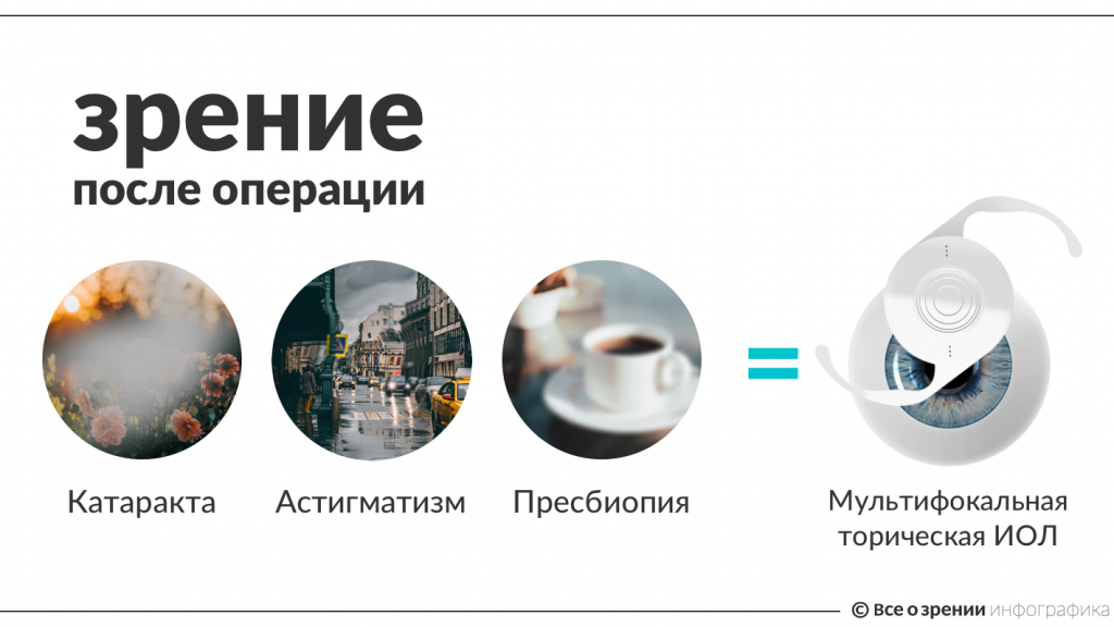 zrenie-posle-operacii.png zrenie-posle-operacii.png
