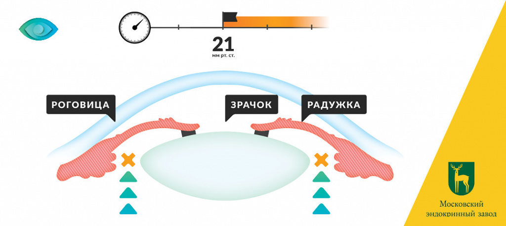 pristup-glaucomy4.jpg