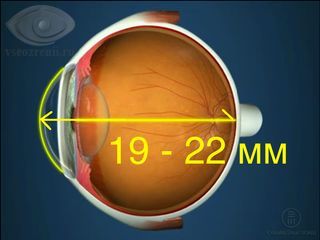 размер глаза при дальнозоркости