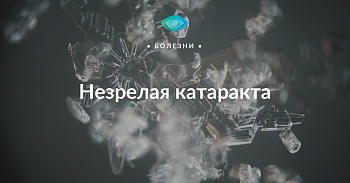 Незрелая катаракта — 9 ответов хирурга на самые важные вопросы