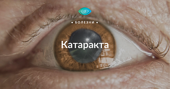Катаракта — причина №1 низкого зрения и слепоты после 50 лет